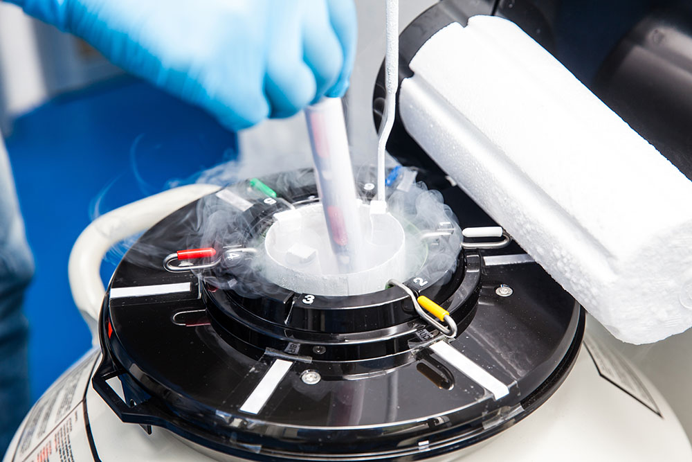 frozen embryo cryopreservation