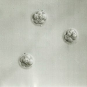 The Beginning of Embryo Adoption